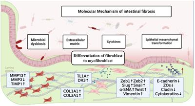 Mechanisms and therapeutic research progress in intestinal fibrosis